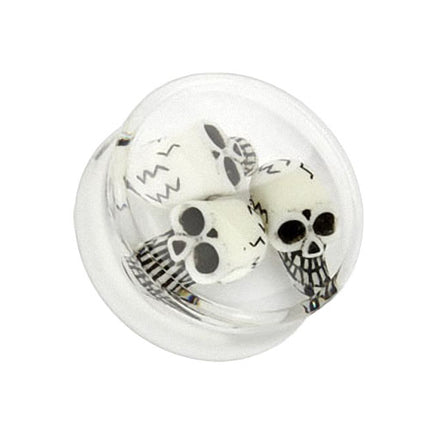 PAE04 / 20mm